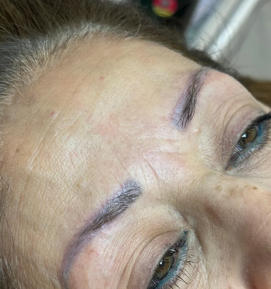 Nanoblading, before